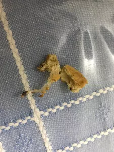 Silicona dentro de una pepito