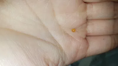 Mordí una bola dura dentro de una mini oreo