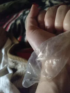 Preservativo roto