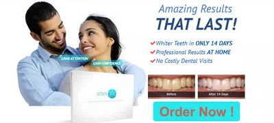Estafa kit de blanqueamiento dental soleil glow , ya casi un año!
