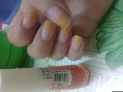 Solucion de un producto en mal estado