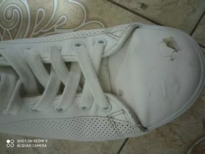 Los tenis se les callo el cuero