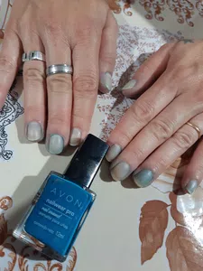 Uñas manchadas