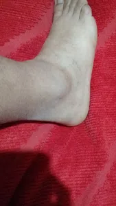 Reclamo