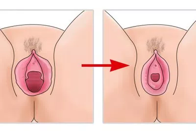 Ocupo de regreso mi virginidad