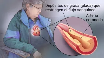 Me cobran por una compra que fué devuelta y están reteniendo