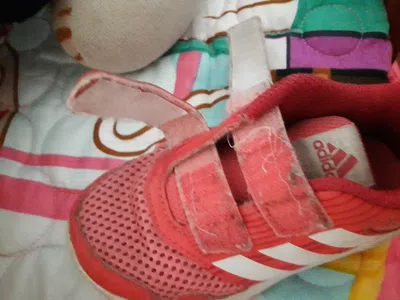 Abrojo de mala calidad