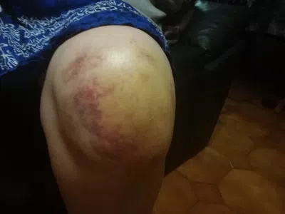 Se cayo señora, piso con agujero y fierro