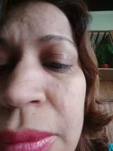 Mal estado en el rostro
