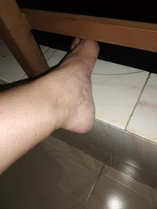Cancelar pedidos