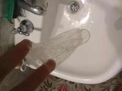 Se rompió totalmente el preservativo en el extremo superior