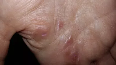 Cuidado. tu mano está en peligro