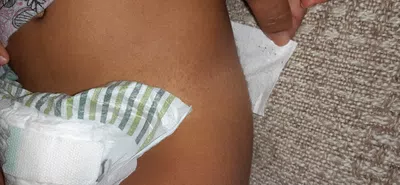 Tiras se cortan del lado izquierdo