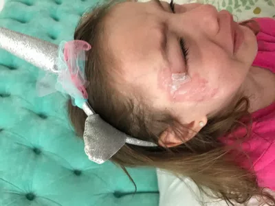 Demanda por herida cortante en menor